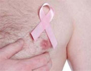 cáncer mama